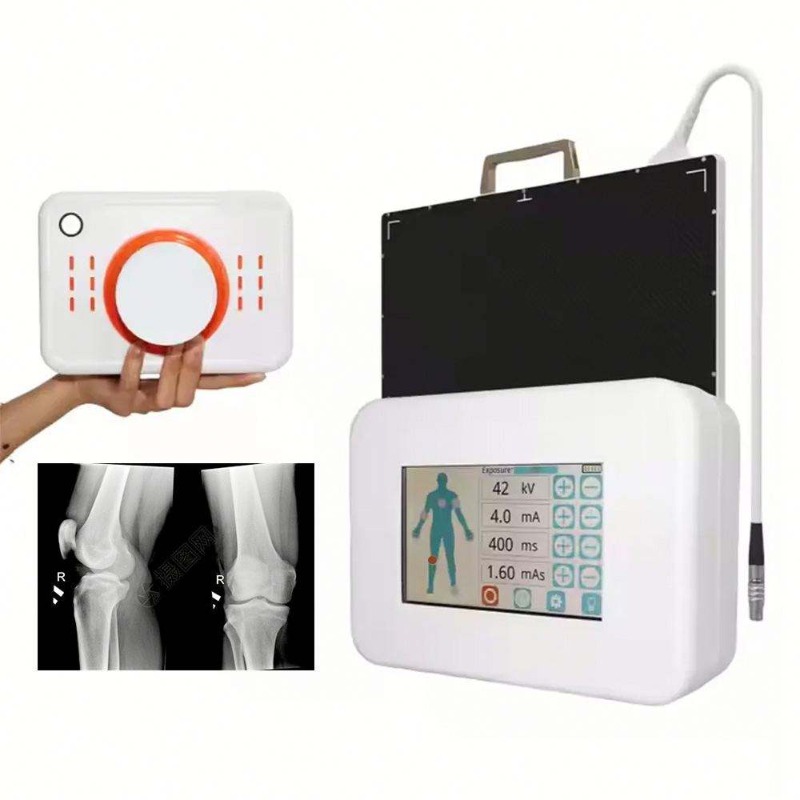 Portable Small Size Hand-Held  - Veterinary X-Ray 评论和价格